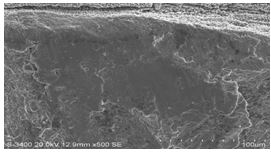 圖11-154 斷面A1、A2區(qū)邊沿微觀形貌